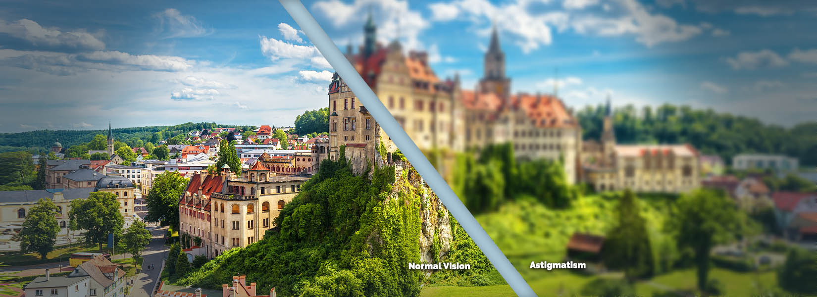 Astigmatism Treatment in Rosana Square Shopping Center